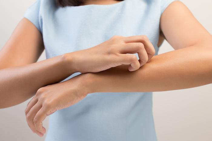 The easiest method to Ease and stop Eczema Flare-ups