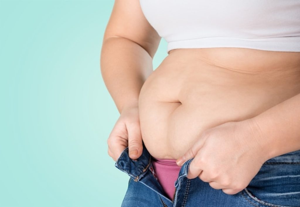 Gastric Sleeve Recovery