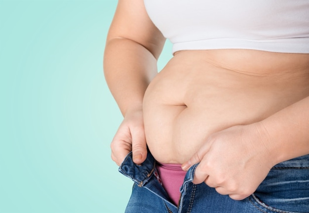 How Long Does Gastric Sleeve Recovery Take?