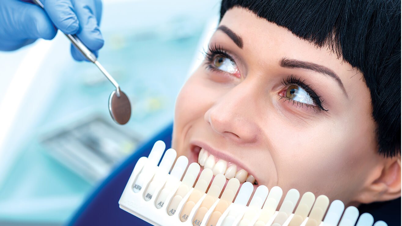 Benefits of professional tooth whitening