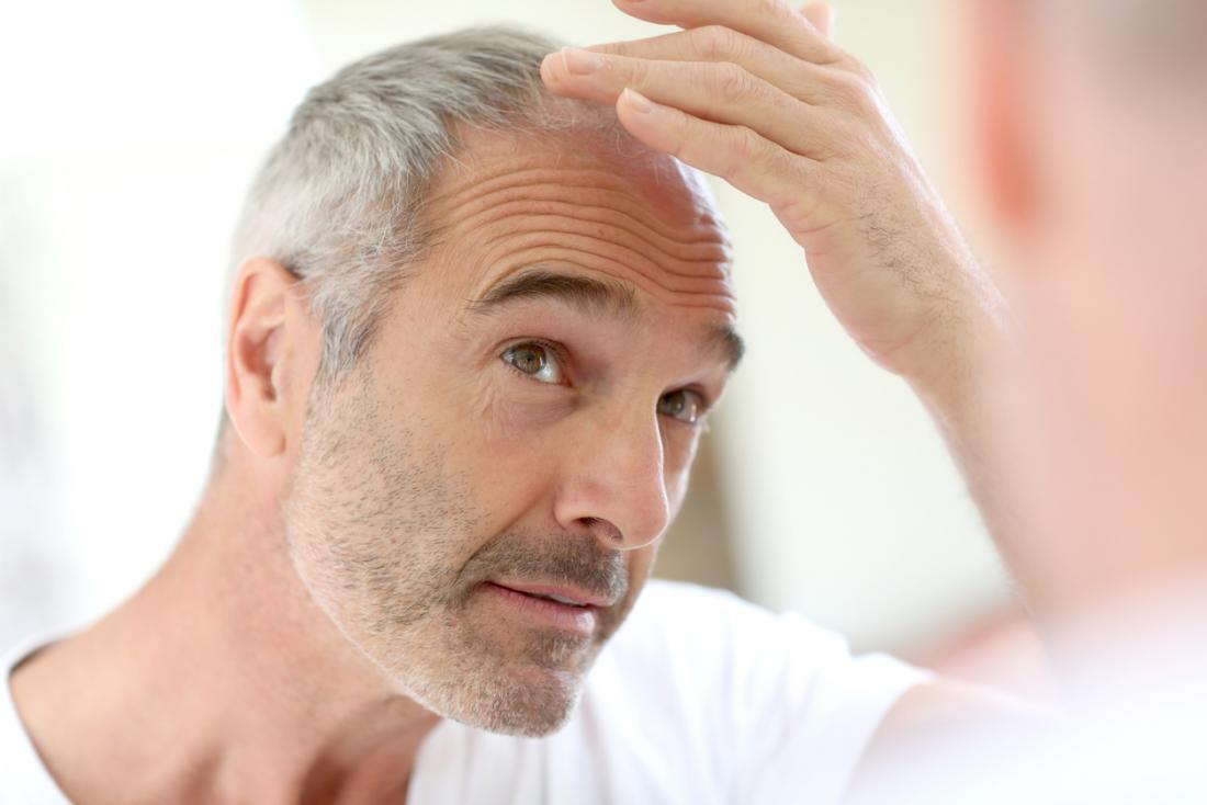 Hair thinning in men: causes and diagnosis