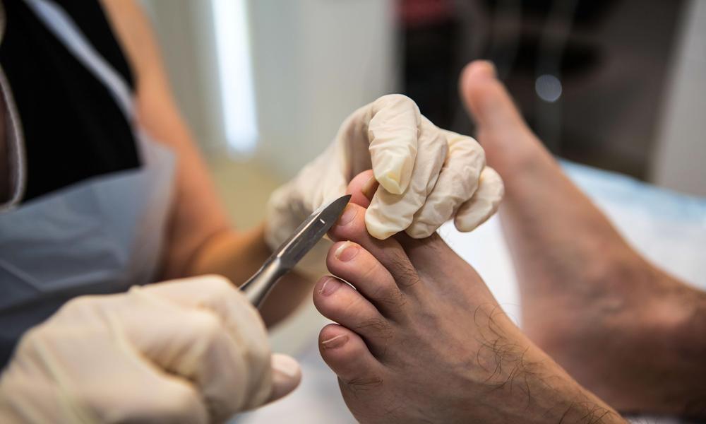 Understanding How To Find a Podiatrist