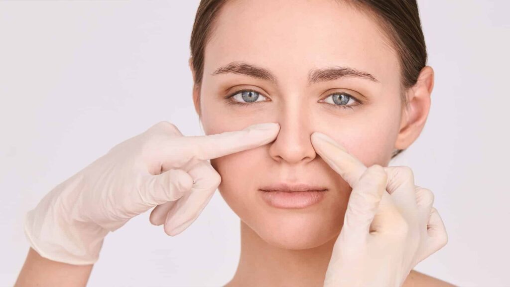 Who is The Ideal Candidate for a Rhinoplasty?