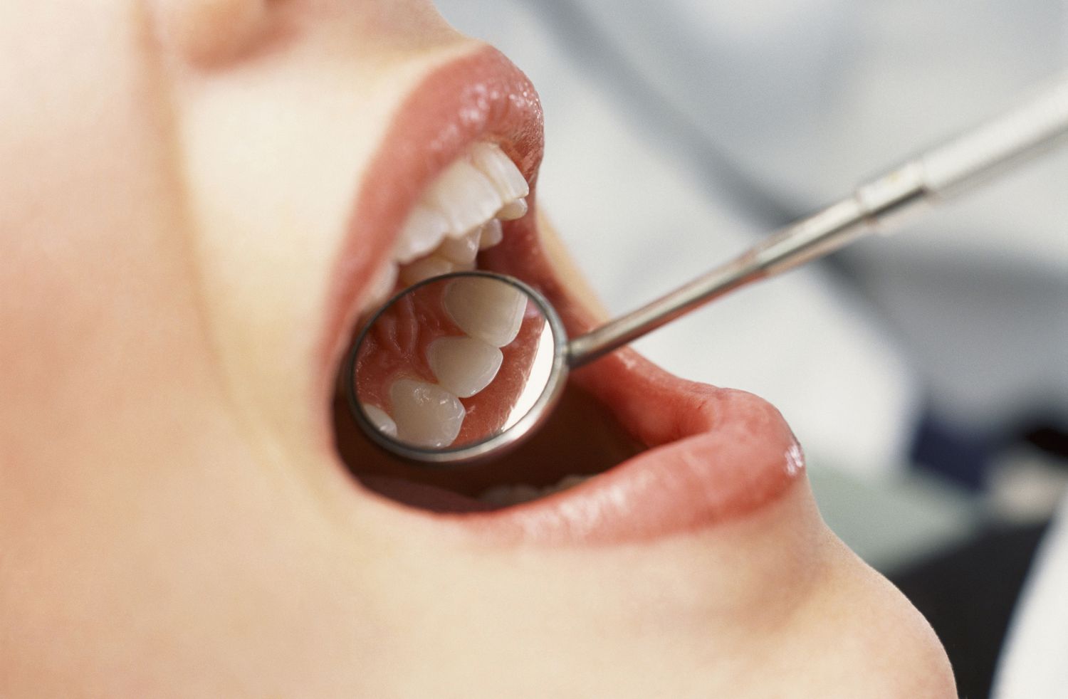 What Are The Major Dental Problems?