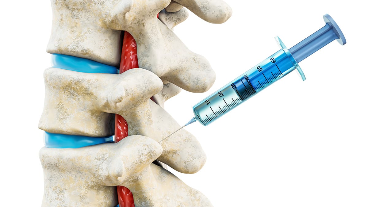  Benefits of facet joint injection services