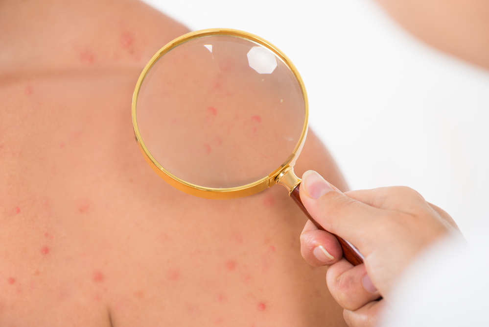 Common Skin Conditions and How Dermatologists Treat Them