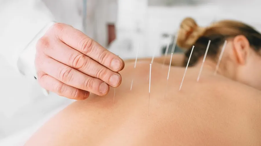Common Ailments Treated by Acupuncture