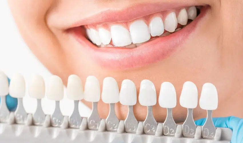 Cosmetic Dentistry Procedures And How They Improve Your Smile