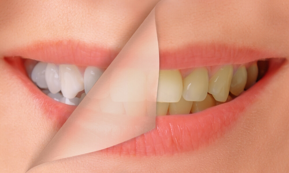 Choosing the Right General Dentist for You