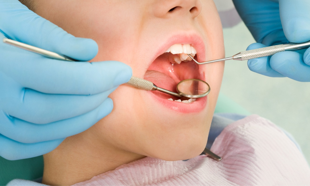 Dental Cleaning in Chicago, IL: Procedure Duration and Benefits